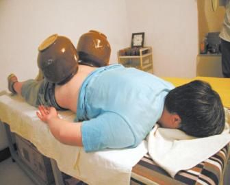 拔泡菜壇子火罐。