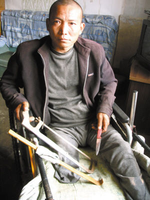 鄭艷良就是用這幾樣簡陋工具，給自己做了右腿截肢手術。