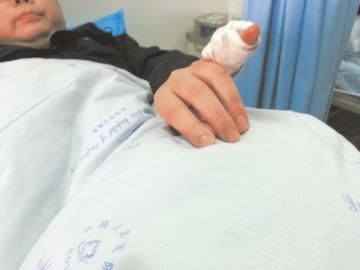 實習(xí)醫(yī)生陳洪左手的小拇指肌腱斷裂。