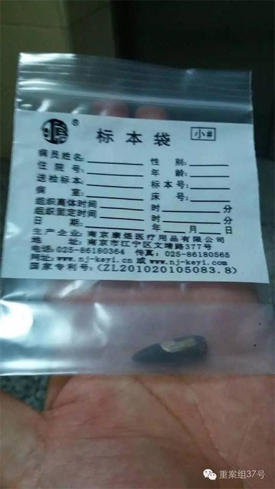 經(jīng)警方鑒定，秦女士體內(nèi)取出的子彈系56式步槍射出 。 受訪者供圖