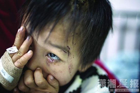 1月13日，湖南省兒童醫(yī)院，4歲的源源用手蒙住了眼睛。