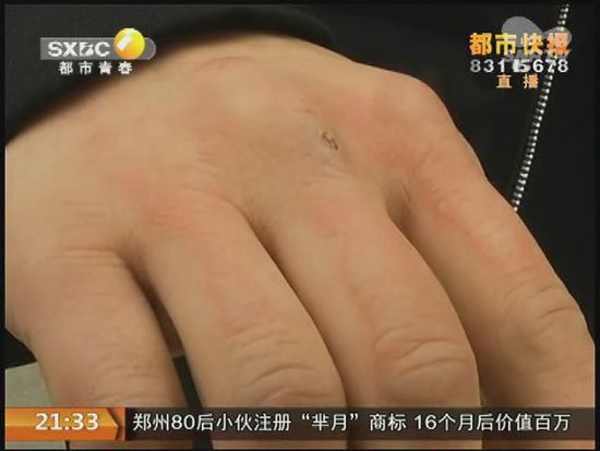 說(shuō)到這足療拔罐，估計(jì)大伙都不陌生，但是想起4號(hào)晚上的拔罐的經(jīng)歷，呂先生現(xiàn)在想起來(lái)，還心有余悸。