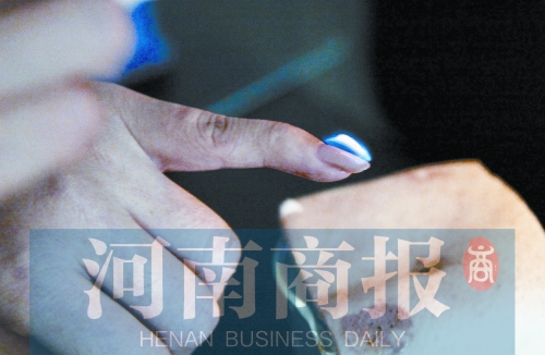 將指甲油涂在指甲上，靠近火焰時被引燃了